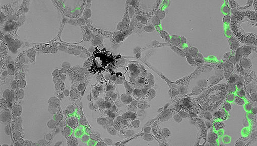 Glomerulus und Sammelrohre ISH