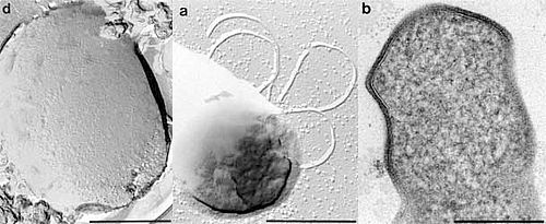 Thermococcus acidaminovorans