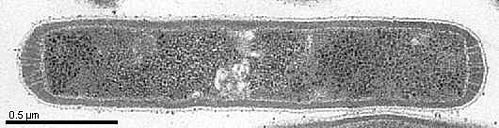 Methanothermus fervidus