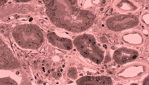 Rote-tubuli630x348