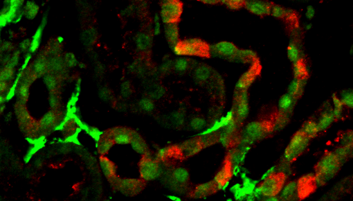 Cx26 Cy5 Gfp Cy2 Uebersicht