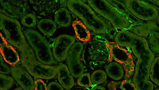 Cx32 Cy5 Gfp Cy2 Uebersicht