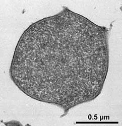 Thermococcus-ch-sec