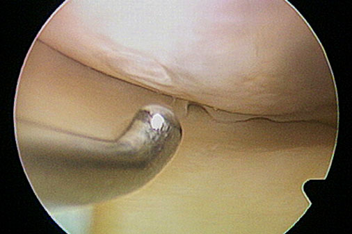 Nach der Transplantation