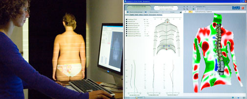 3D Scan 